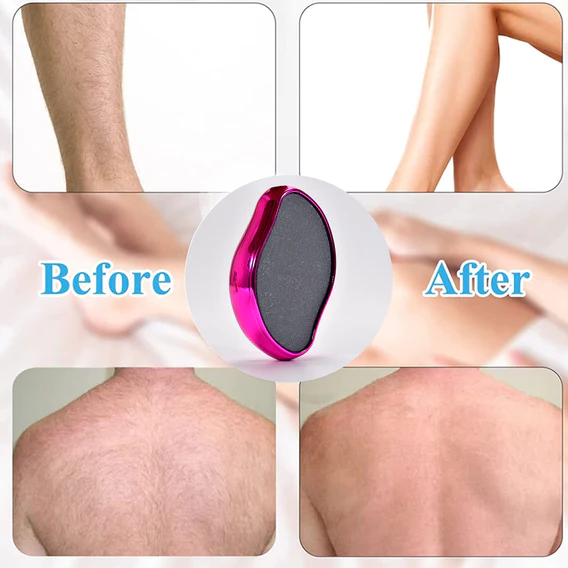 6603 Crystal Epilator, Painless Physical Hair Removal Tool, Safe and Effective Hair Removal Magic Tool for Arms, Legs, Back and Body Physical Hair - Image 4