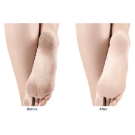 6195 Grinding Feet Artifact Exfoliating Nano glass Grinding Stone House Frustrated Feet Foot Scraping Heel