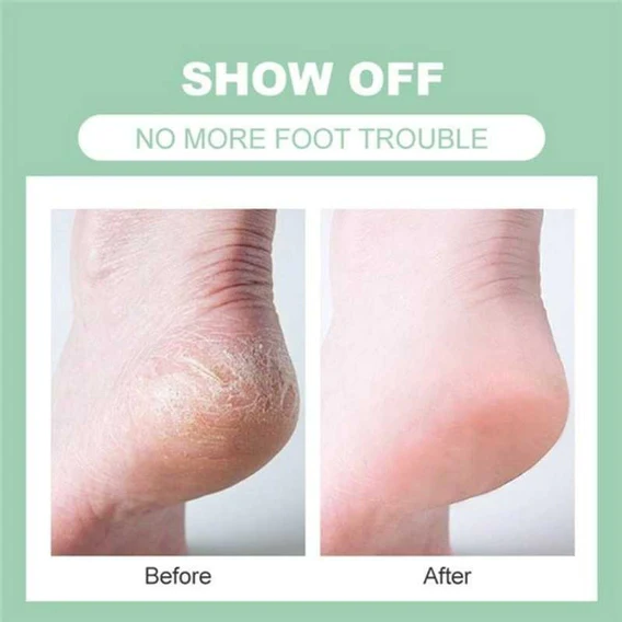 1472 Silicone Gel Heel Pad Protector Insole Cups for Heel Swelling Pain Relief - Image 4