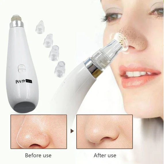 0351A BLACKHEAD REMOVER VACUUM SUCTION FACIAL PORE CLEANER DERMABRASION FACE FACIAL PORE CLEANER, BEAUTY DEVICE KIT WITH 4 SUCTION PROBES FOR WOMEN & MEN - Image 3